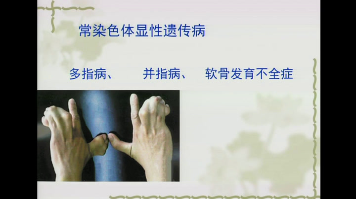 苏教版生物必修2《第五节关注人类遗传病》江苏李老师-市一等奖